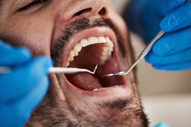 Best Emergency Treatment for Oral Infections in Mount Vernon, WA